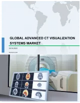 Global Advanced CT Visualization Systems Market 2018-2022
